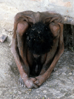 Dying Beggar in India